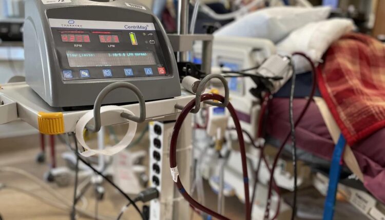 ECMO Life Support Is a Last Resort for Covid, and in Short Supply in South