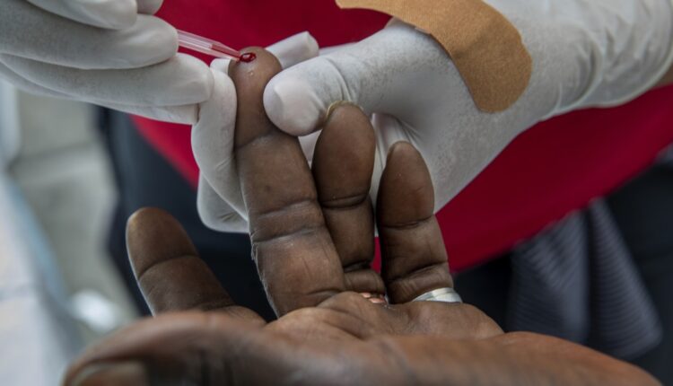 LA County is seeing an increasing number of babies with syphilis

